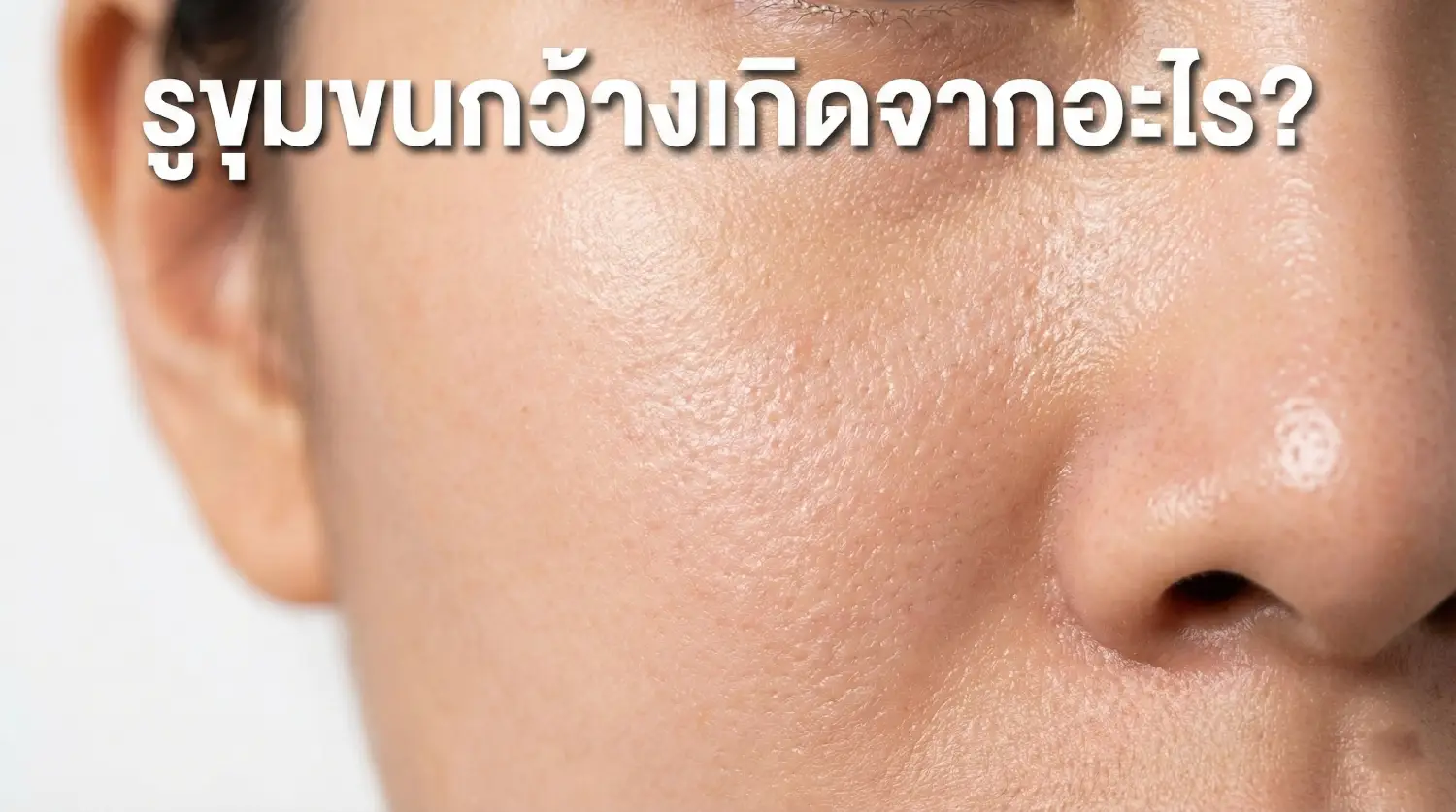 รูขุมขนกว้างคืออะไร